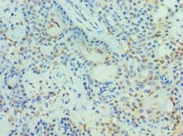 Polyclonal Rabbit anti-Human PIAS3 Antibody (aa399-628, IHC)
