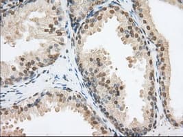 PDE4A / PDE4 Antibody (clone OTI1C8)