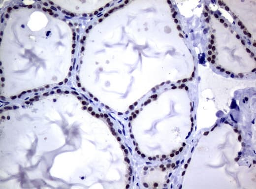 MGMT Antibody (clone UMAB52, Carrier-free)
