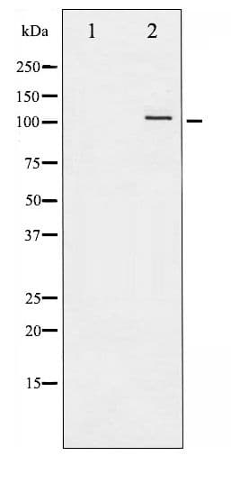 NFKB1 / NF-Kappa-B Antibody (phospho-Ser907)
