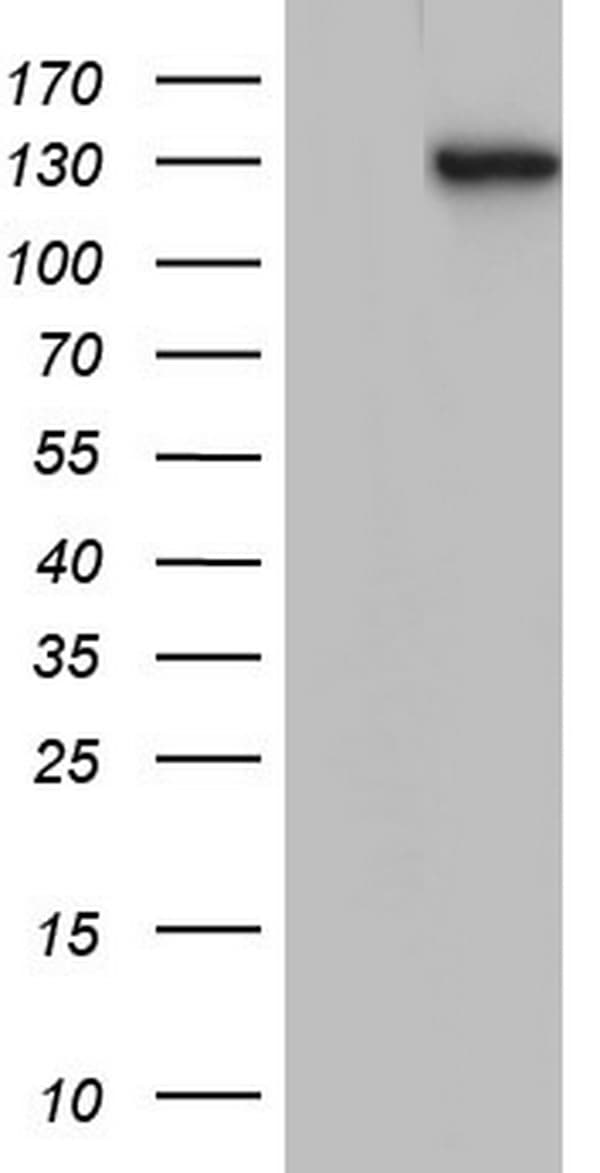 TACC2 Antibody (aa727-1026, clone OTI4F10, Carrier-free)