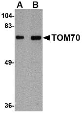Polyclonal Rabbit anti-Human TOMM70A Antibody (IHC, IF, WB)