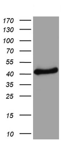 Tyrosinase Antibody (aa19-320, clone UMAB257)