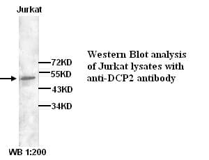 IHC-plus™ DCP2 Antibody