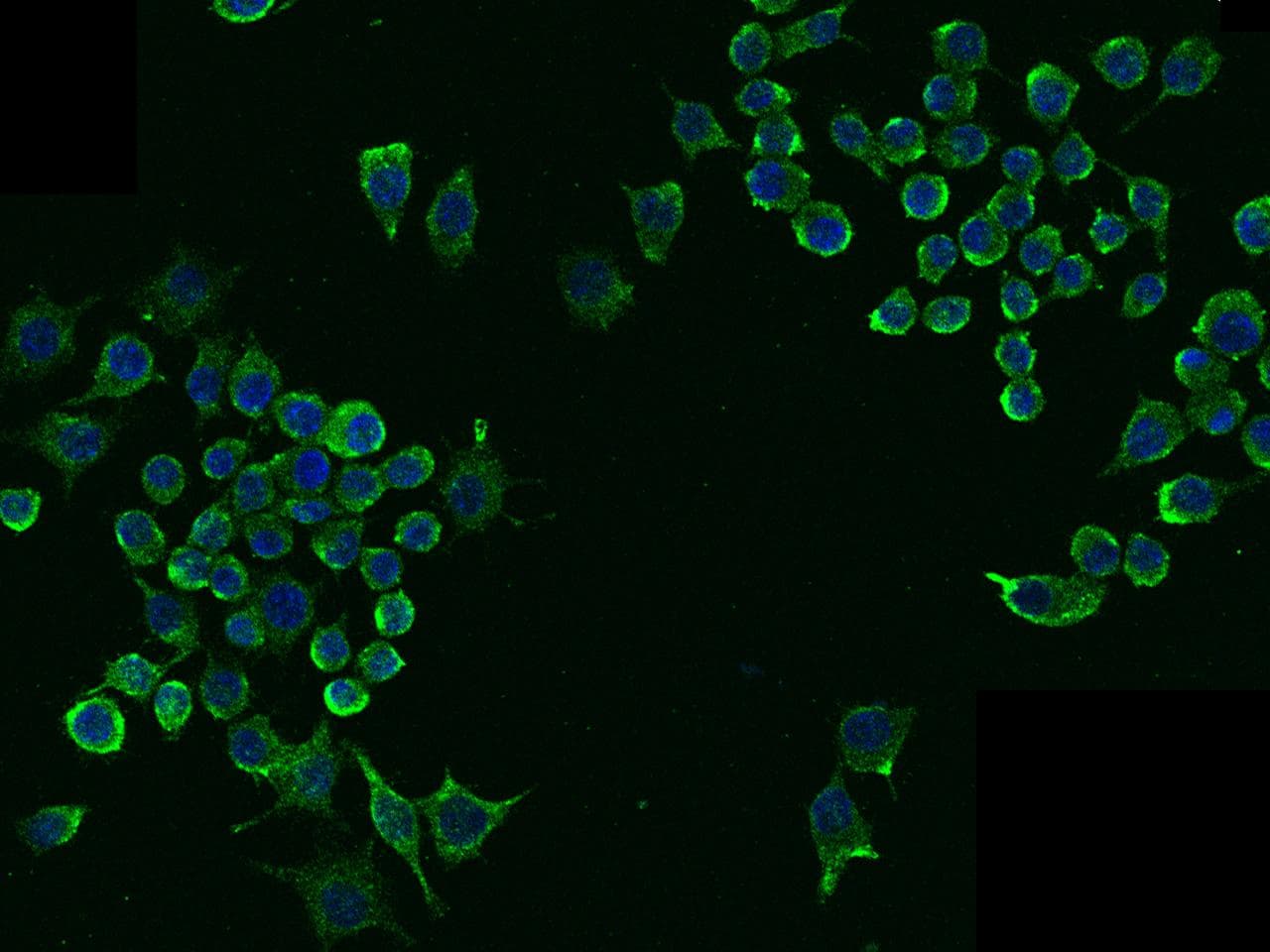LDLR / LDL Receptor Antibody (aa1-790, clone 101, Preservative Free)