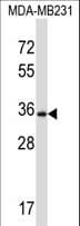 DTX3 Antibody (aa20-48)