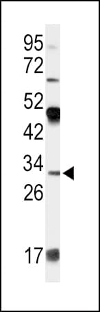 IHC-plus™ APOD / Apolipoprotein D Antibody (aa26-53)