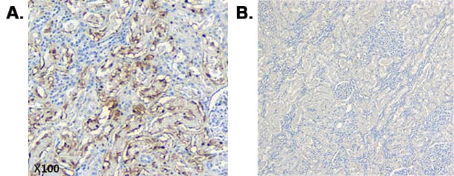 Monoclonal Mouse anti-Human C1QTNF6 / CTRP6 Antibody (clone 256-E, Globular domain, IHC, WB)