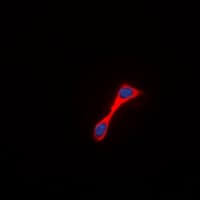 KDR / VEGFR2 / FLK1 Antibody (C-Terminus)
