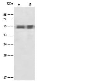SERPINA1 / Alpha 1 Antitrypsin Antibody (Preservative Free)