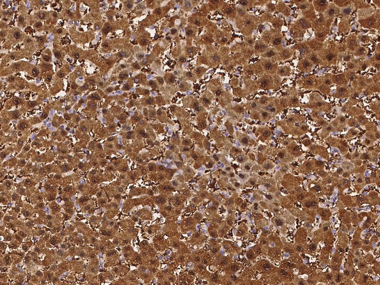 ARG1 / Arginase 1 Antibody