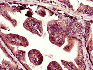 UHMK1 / KIS Antibody