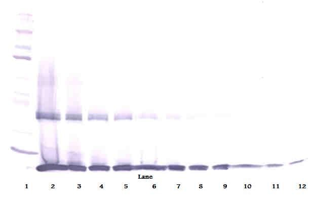 IL-1B / IL-1 Beta Antibody