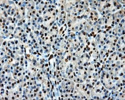 LOX / Lysyl Oxidase Antibody (clone OTI9G6)