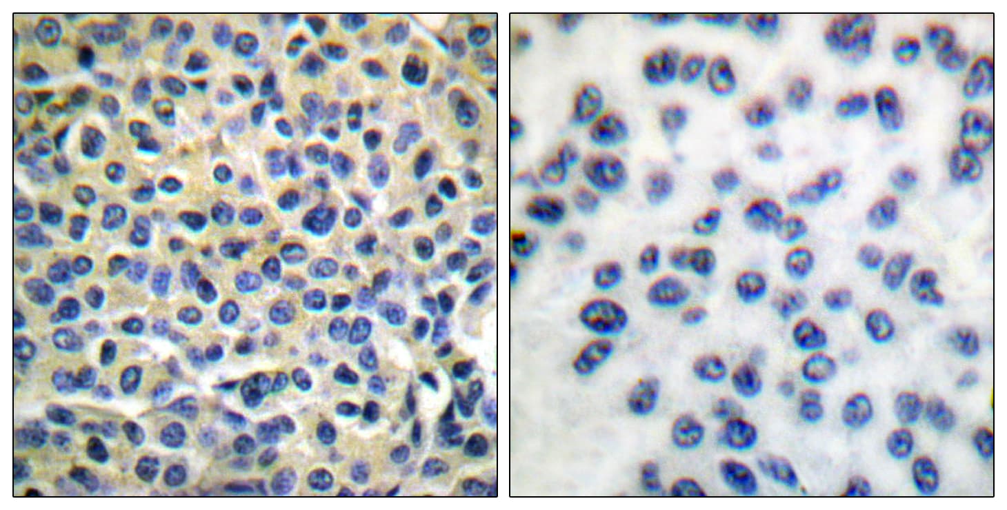 LIMK1 + LIMK2 Antibody (aa481-530)