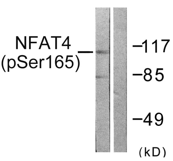 NFAT4 / NFATC3 Antibody (phospho-Ser165)
