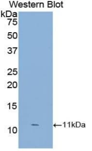 S100A8 / MRP8 Antibody (aa1-89)