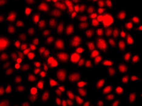 NR2E1 / TLX Antibody