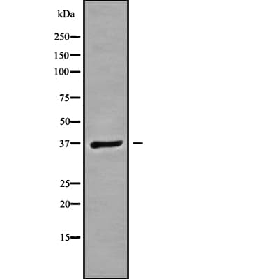 Polyclonal Rabbit anti-Human GNB3 Antibody (IF, WB)