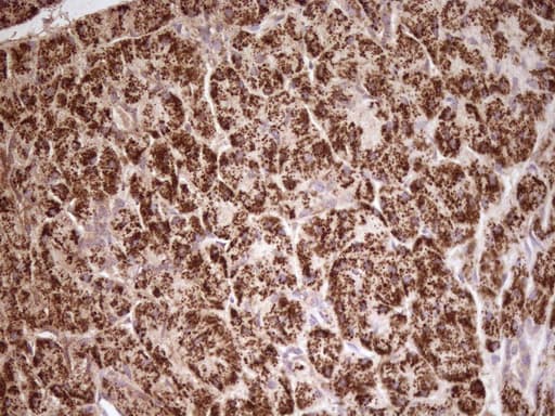 Monoclonal Mouse anti-Human ABAT Antibody (clone UMAB178, aa29-323, IHC, IF, WB)