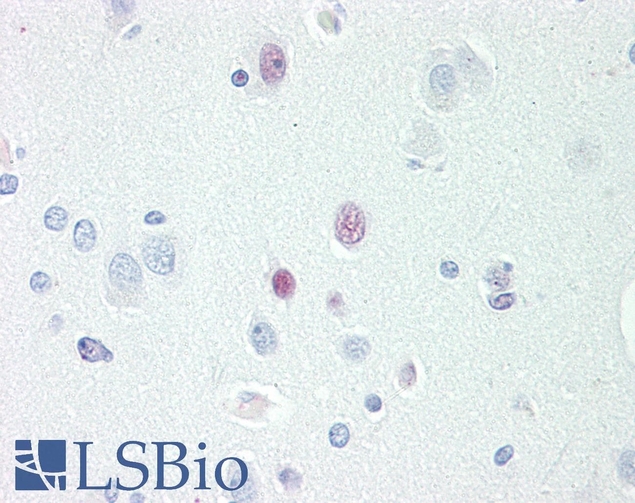 IHC-plus™ TCEAL3 Antibody (aa15-43)