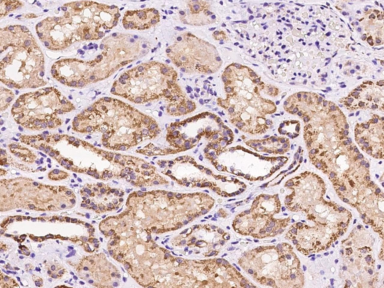 MRPL20 Antibody