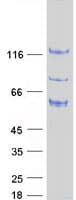 Human ARHGAP17 / NADRIN Protein (Recombinant Myc-DDK (Flag))