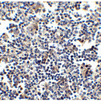 CCR5 Antibody