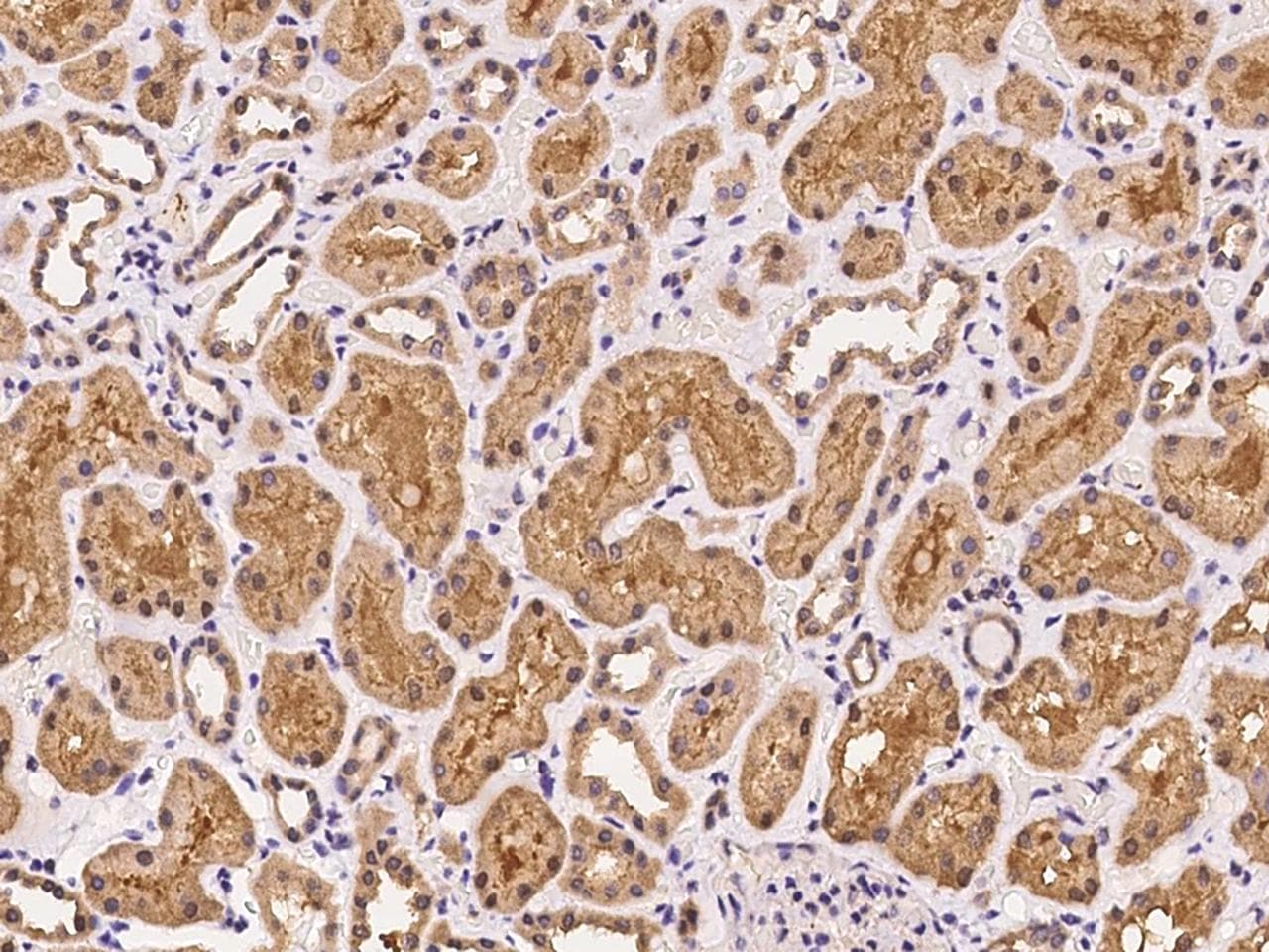 Polyclonal Rabbit anti-Human UBXN6 / UBXD1 Antibody (IHC)