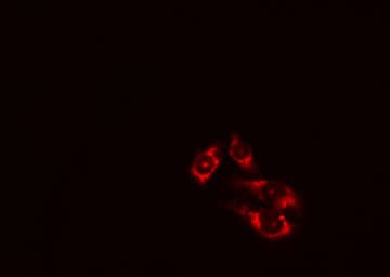 ATG4D Antibody