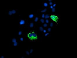 PPP1R15A / GADD34 Antibody (clone OTI2B11)