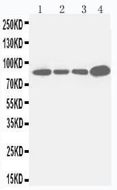 Polyclonal Rabbit anti-Human ITGB3 / Integrin Beta 3 / CD61 Antibody (aa752-770, IHC, WB)