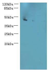 Polyclonal Rabbit anti-Human L3HYPDH / C14orf149 Antibody (IHC, WB)