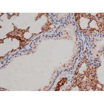 Polyclonal Rabbit anti-Human LYN Antibody (phospho-Tyr508, IHC, IF, WB)