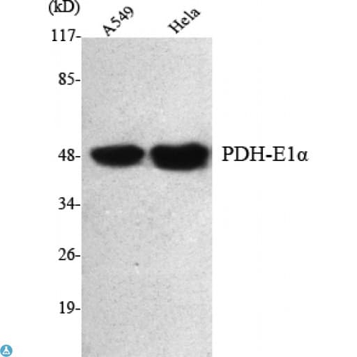 PDHA1 / PDH E1 Alpha Antibody