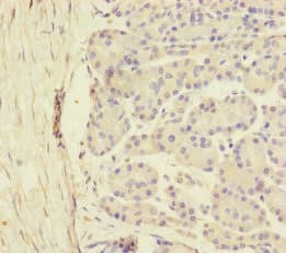 Polyclonal Rabbit anti-Human SCFD1 / SLY1 Antibody (IHC, WB)
