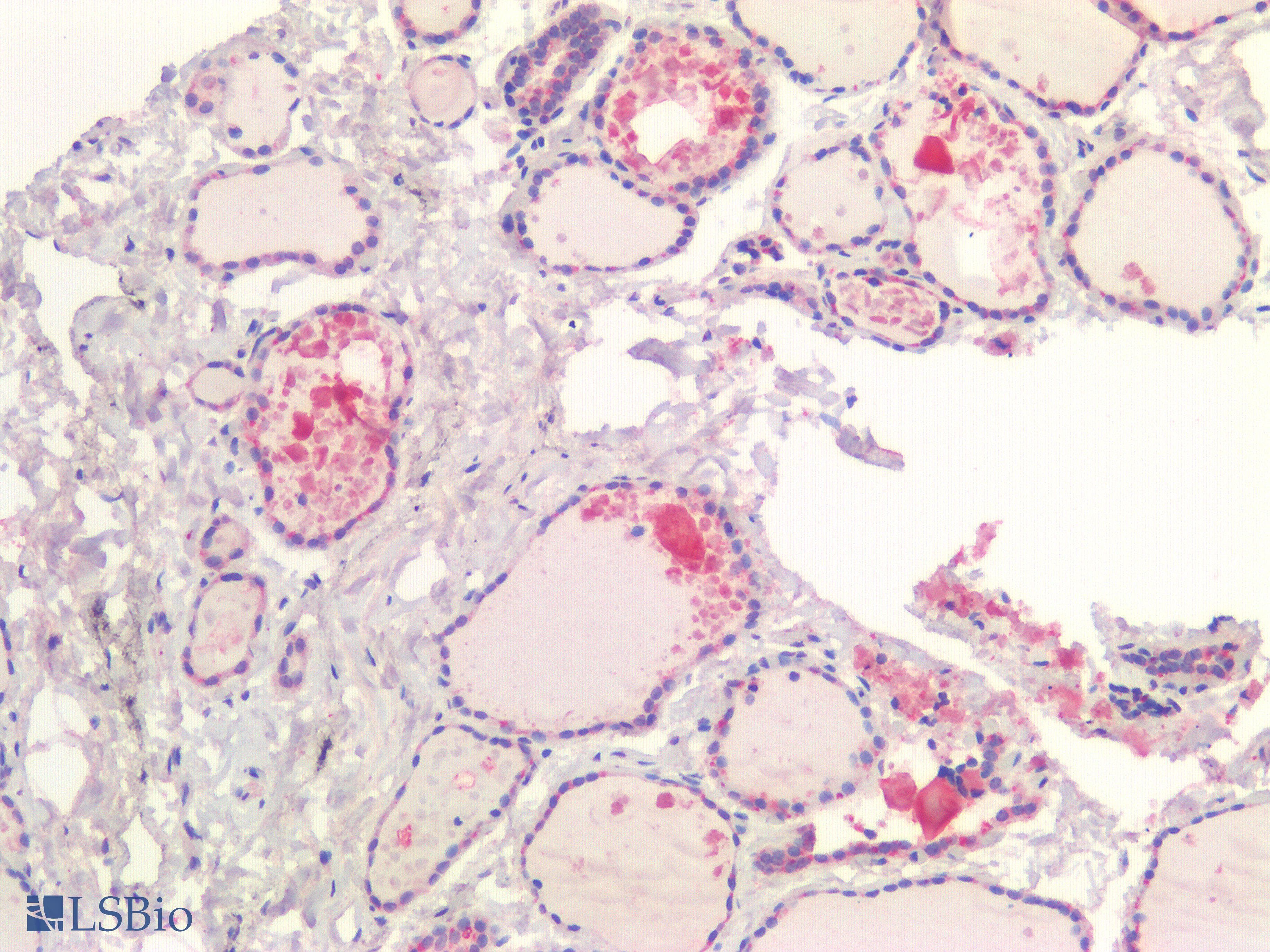 IHC-plus™ TIAM1 Antibody