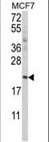 Polyclonal Rabbit anti-Human APG12 / ATG12 Antibody (aa8-38, IF, WB)
