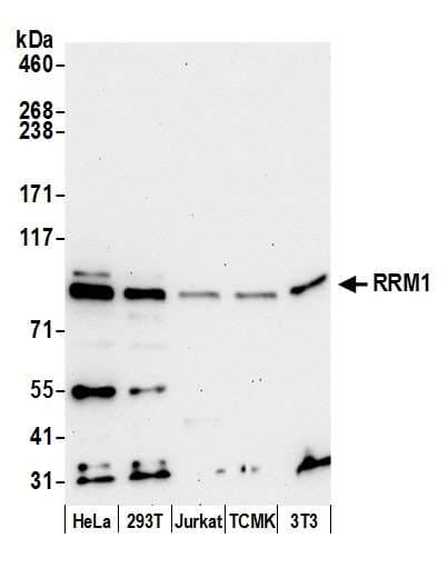 R1 / RRM1 Antibody (aa742-792)