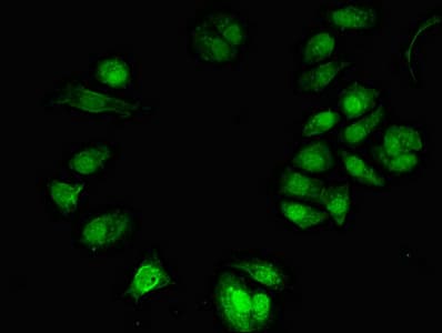 Polyclonal Rabbit anti-Human TONSL Antibody (IF)
