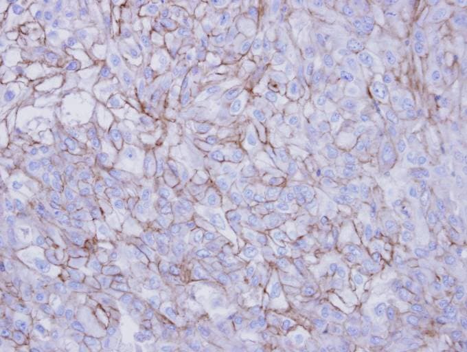 DSG2 / Desmoglein 2 Antibody (aa1-206)