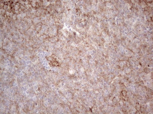 CLU / Clusterin Antibody (aa23-227, clone OTI5D3, Carrier-free)