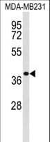 EXTL2 Antibody (aa269-295)