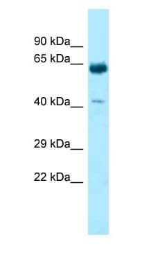 KRT9 / CK9 / Cytokeratin 9 Antibody (aa381-430)