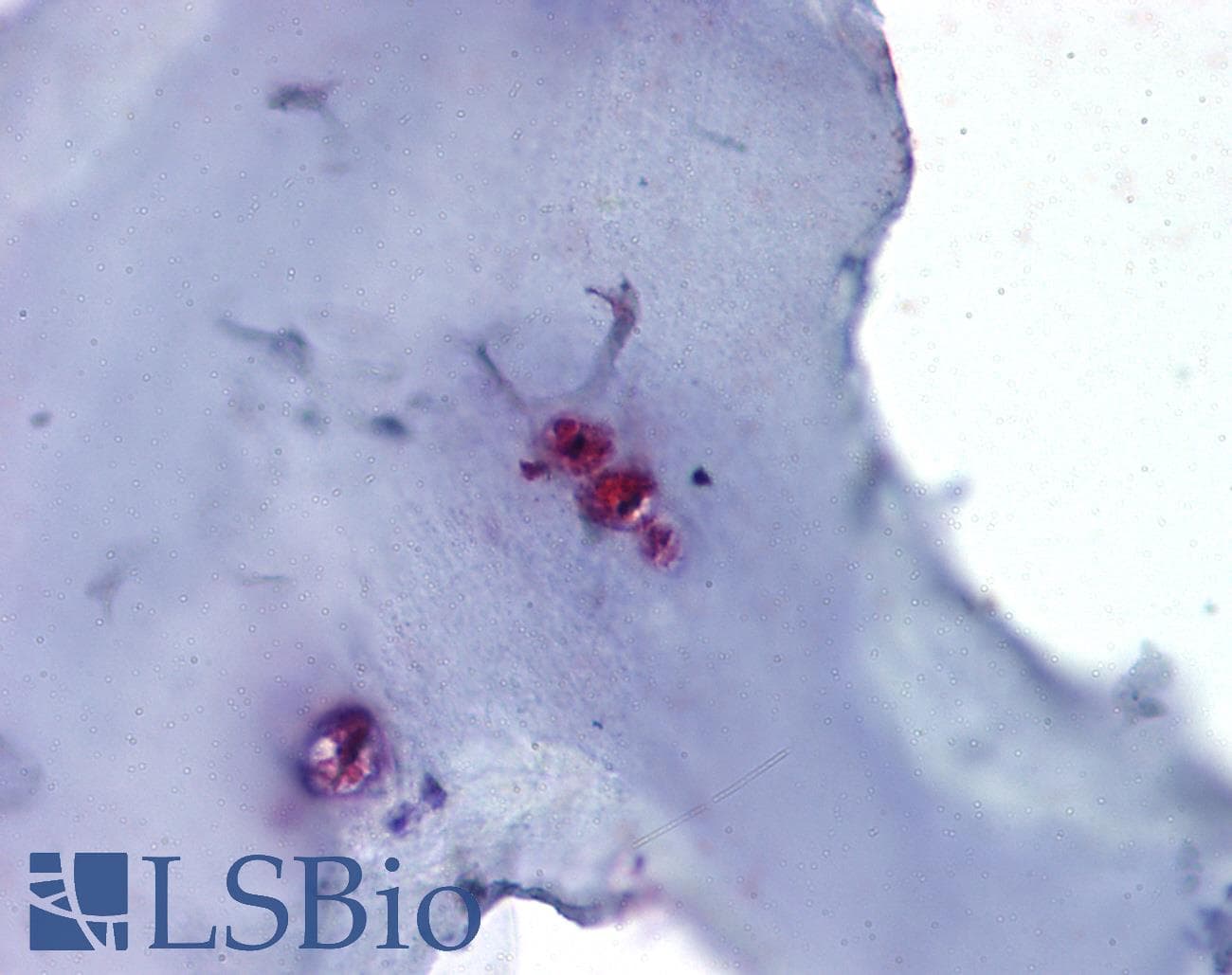 IHC-plus™ Polyclonal Rabbit anti-Human ACAN / Aggrecan Antibody (Internal, IHC)
