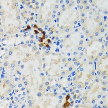GABARAP Antibody