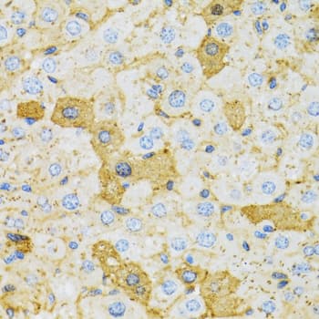 Polyclonal Rabbit anti-Human OXA1L / OXA1 Antibody (IHC, IF, WB)