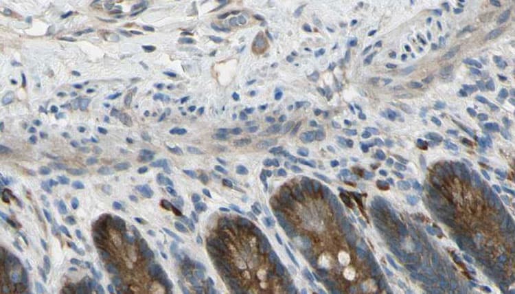 CDH22 / Cadherin 22 Antibody