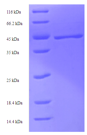 Aequorea victoria GFP Protein (Recombinant His-SUMO)