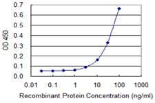 PathPlus™ IFNAR1 / IFNAR Antibody (clone 1H2)